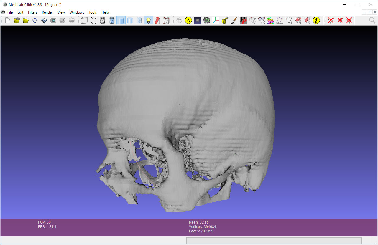 osirix dicom to stl