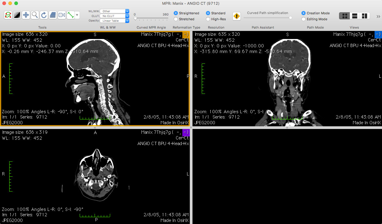 osirix lite how to use