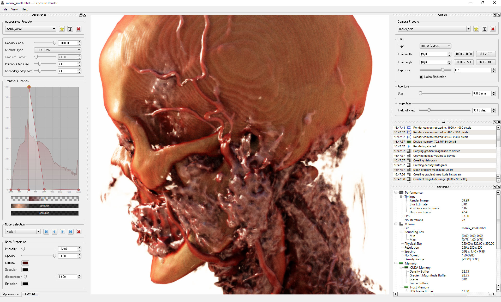 DICOM Render Exposure